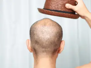 man taking off his brown hat