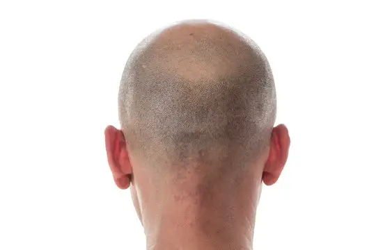 Smooth Shaved Head