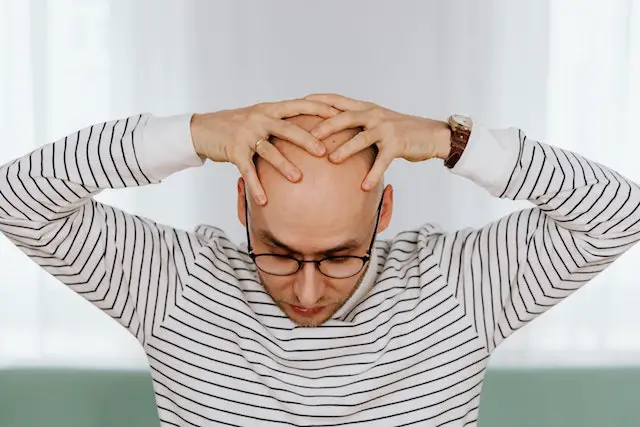 guy's hands holding his bald head